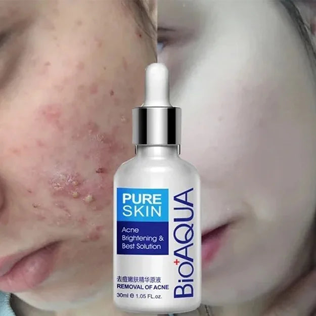 KIT LIMPIEZA PROFUNDA PARA LA CARA