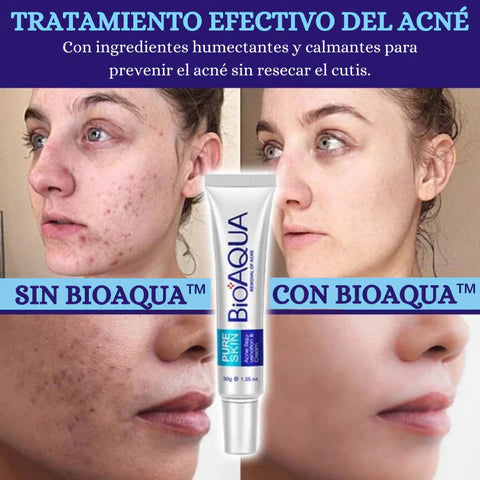 KIT LIMPIEZA PROFUNDA PARA LA CARA