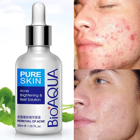 KIT LIMPIEZA PROFUNDA PARA LA CARA